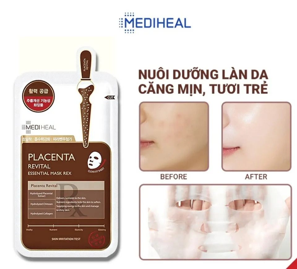 Mặt Nạ Nhau Thai Cừu Phục Hồi Da Placenta Revital Essential Mask REX 24ml -  Mediheal | Aemi